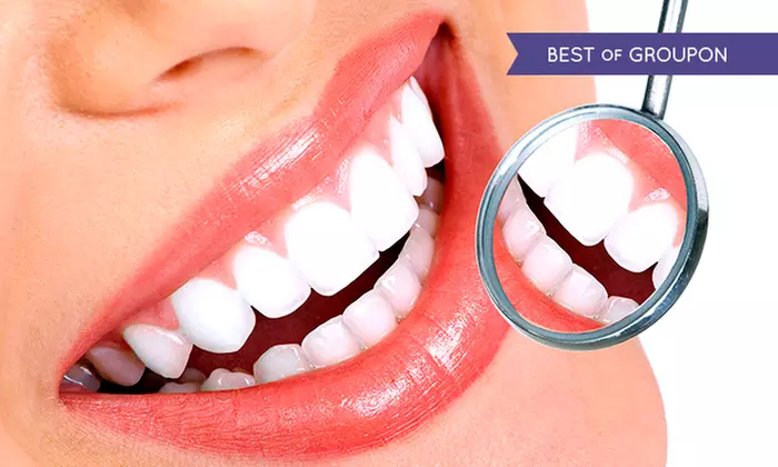 Teeth Whitening Treatment from £99 at Bridge Street Dental Practice - Primary Image