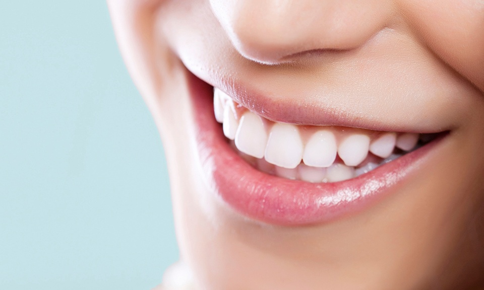 Choose From In-Office Teeth Whitening or Take-Home Kits