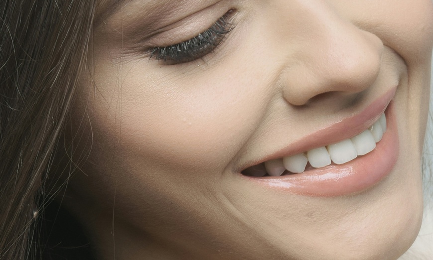 Image 1: 30 or 60-Minute Teeth Whitening Or 60-Minute Teeth Whitening for Two