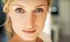 $1,199 for an Upper-Eyelid Lift on Both Eyes from James C. Sanderson, M.D. ($3,800 Value)