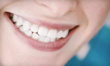 $129 for Zoom Teeth-Whitening Treatment at Smile Arts of NY ($600 Value) - Primary Image