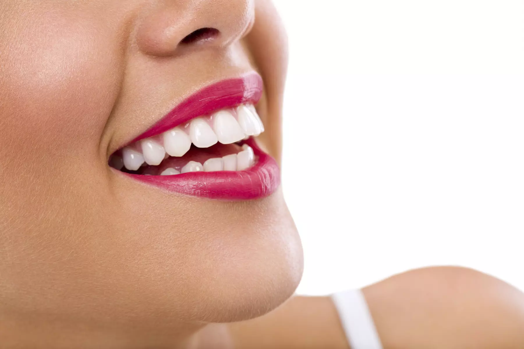 Up to 34% Off on Teeth Whitening at GOLD WHITE BEAUTY CARE - Primary Image