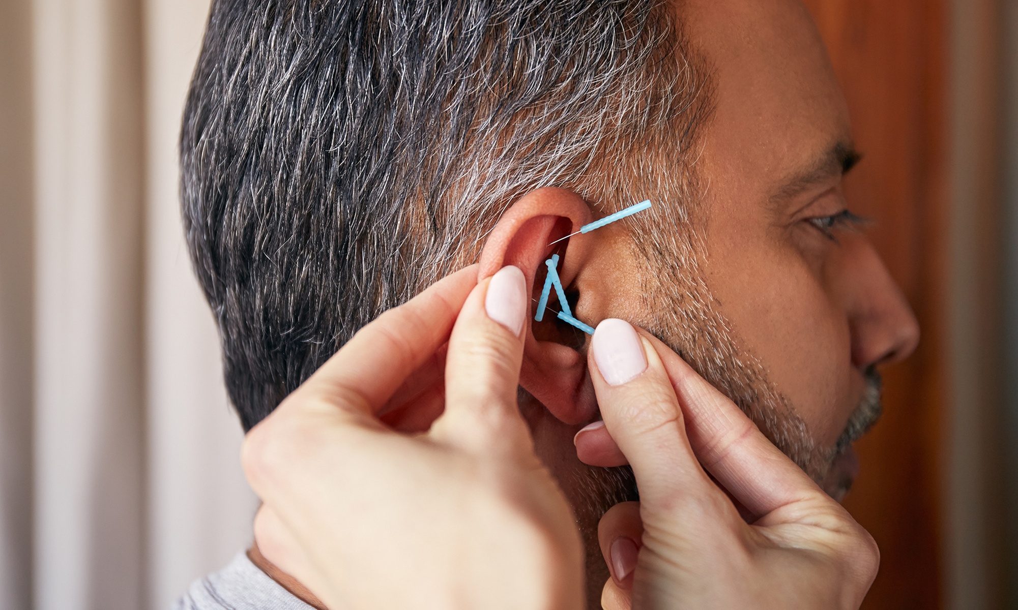 1x - 5x 30 Min. Ohr-Akupunktur zum Thema nach Wahl inkl. Anamnese