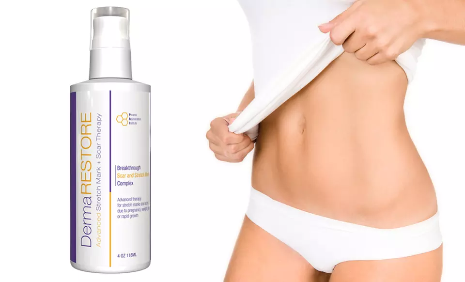 DermaRESTORE Stretch-Mark- and Scar-Treatment Cream; 4oz. - Primary Image