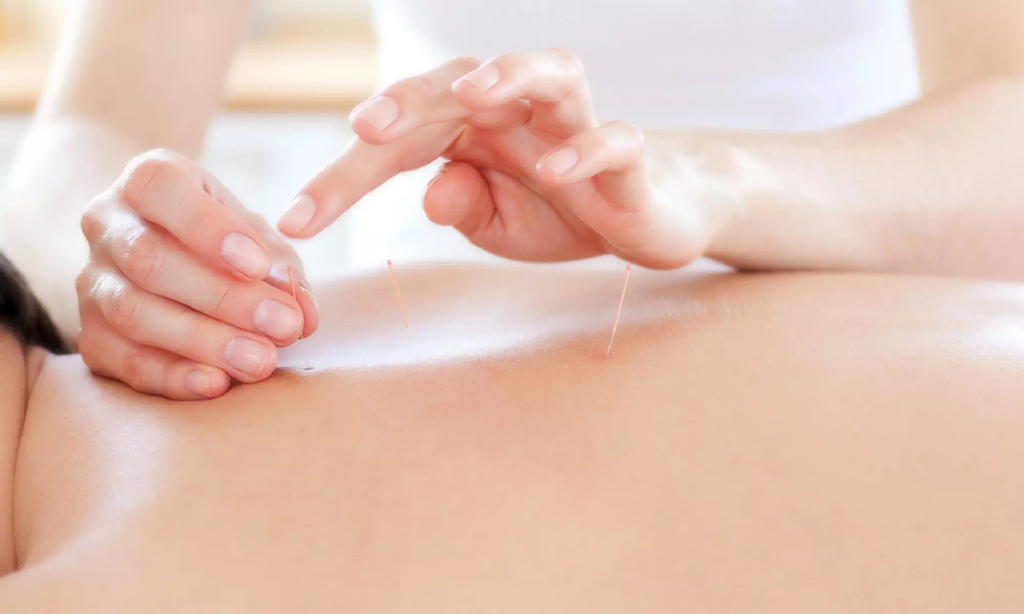 One or Three 60-Minute Tui-na Massage, Cupping, or Acupuncture Treatments at Spring Stream Acupuncture (Up to 51% Off) - Primary Image