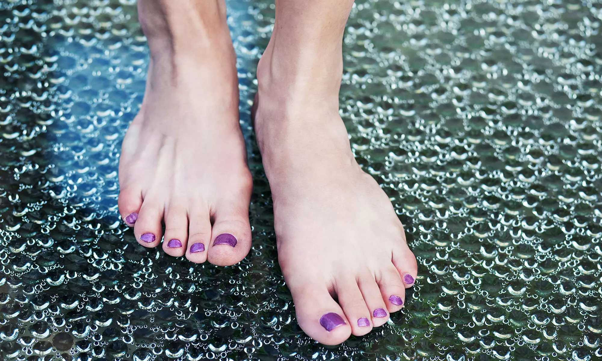 Foot Care, Laser Heel-Pain Treatment, or Laser Fungus Removal for One or Both Feet at 44 Footcare (Up to 86% Off) - Primary Image