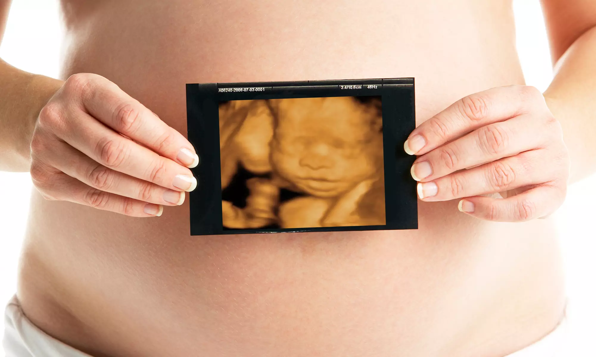 2-D, 3-D, and 4-D Ultrasound and Gender-Determination Packages at Baby's First Photos (Up to  60% Off)  - Primary Image