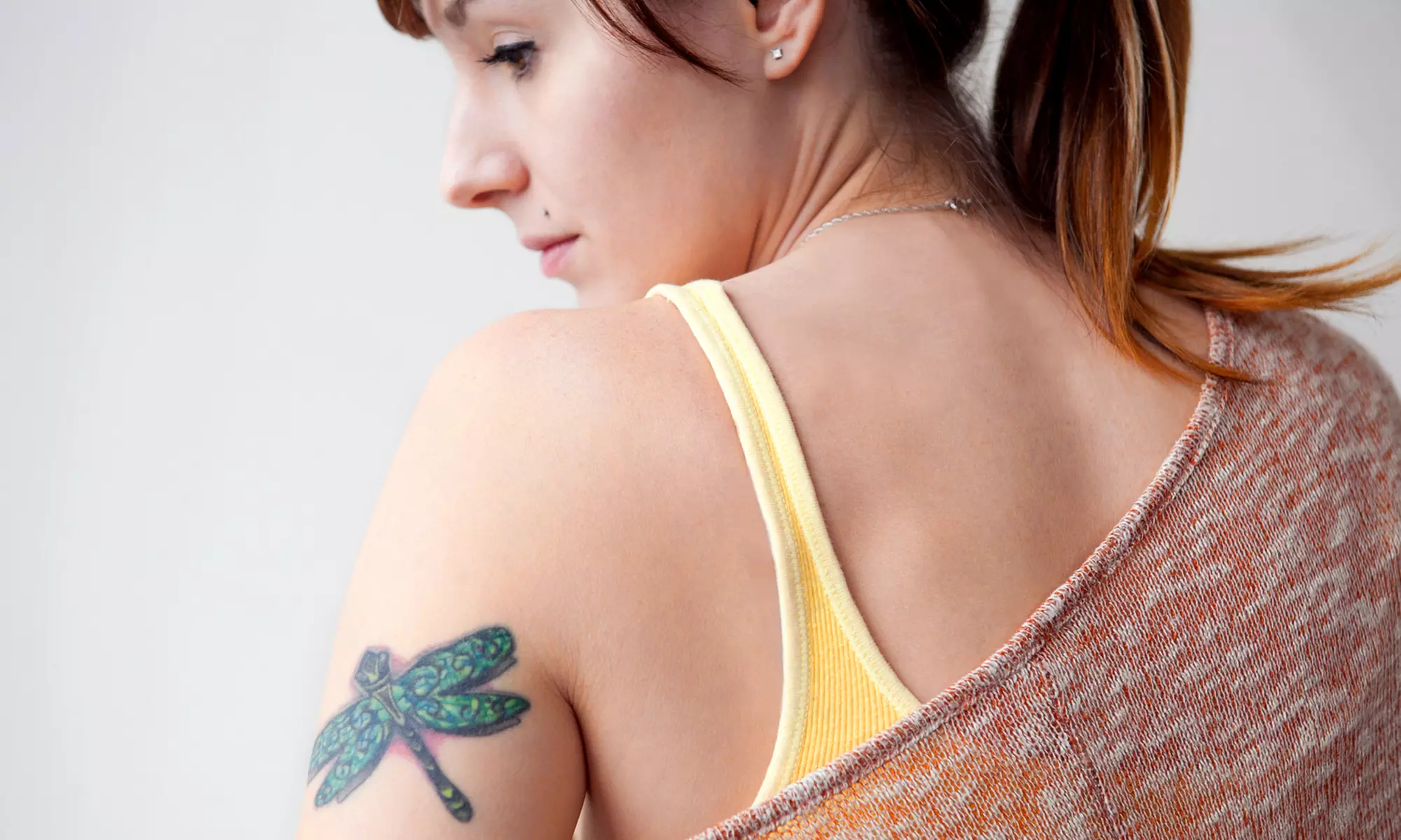 Three Tattoo-Removal Treatments at Advanced Life Clinic (Up to 54% Off). Three Options Available. - Primary Image