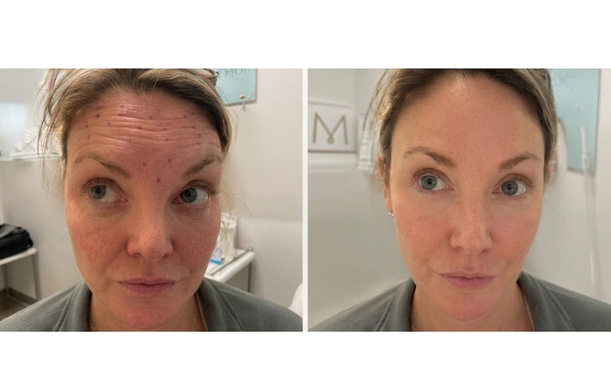 Image 3: Bioidentical Hormone Optimization for Men & Women (60-90 min)