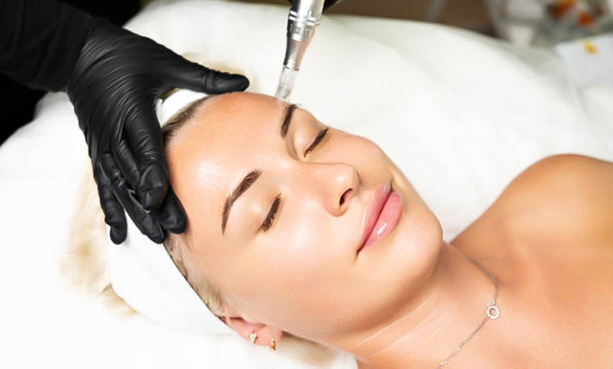 Image 1: Microneedling inkl. Ampulle