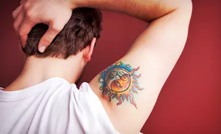 Laser Tattoo Removal for an Area Up to 4”x4”, 6”x6”, 8”x8”, or 10”x10” at Weiler Plastic Surgery (Up to 59% Off) - Primary Image