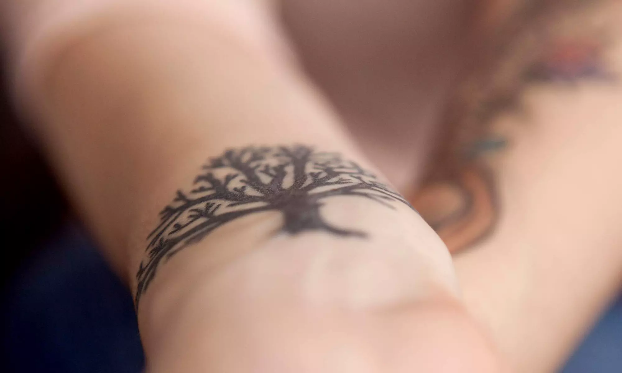 One, Two, or Three Laser Tattoo-Removal Sessions at Dr. Laser Ottawa (Up to 81% Off) - Primary Image