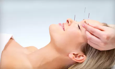 One or Three Cosmetic Acupuncture Treatments from Dr. Marni Ross, ND at Alma Wellness (Up to 64% Off) - Primary Image