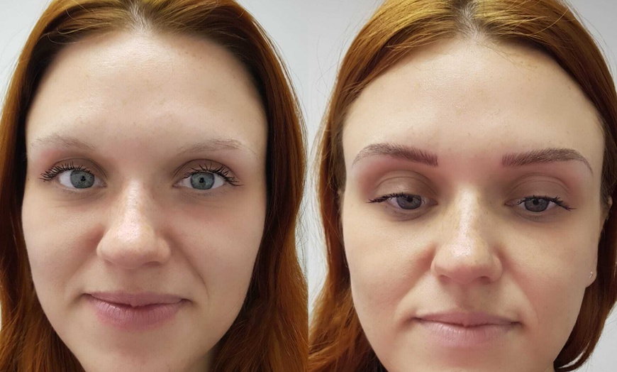 Image 2: Radiant Skin with 1 or 3 Glass Skin Facial or Glass Facial Treatment