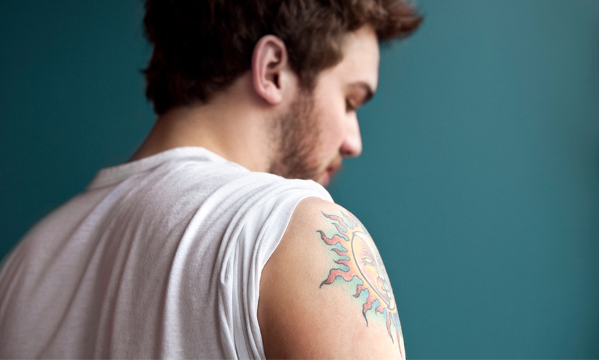 Image 1: Laser Tattoo Removal, 83% Off