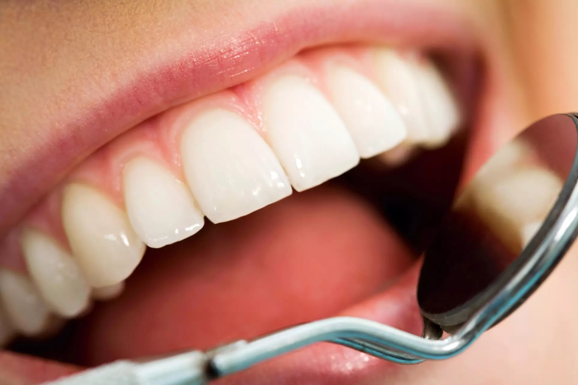 $260 Off Exam and Full Mouth X-Ray at North Shore Dental Group - Primary Image