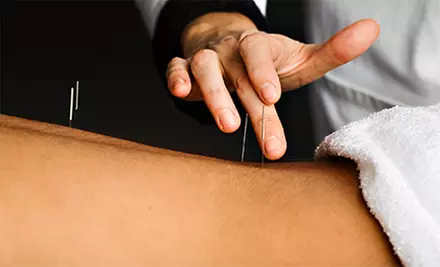 $23 for $50 Worth of Services at Gloria Acupuncture Clinic - Primary Image