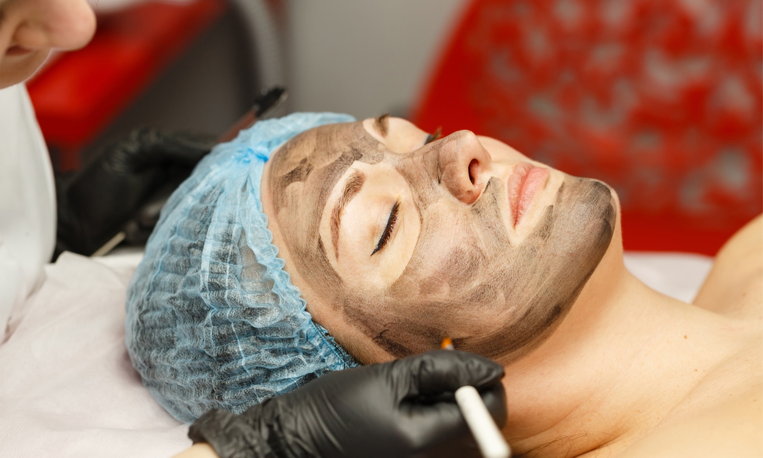 Refresh Your Skin with Black Doll Carbon Peel Laser Options