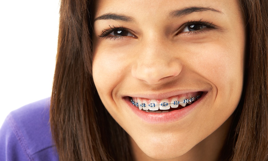 Image 1: Ortodoncia con brackets