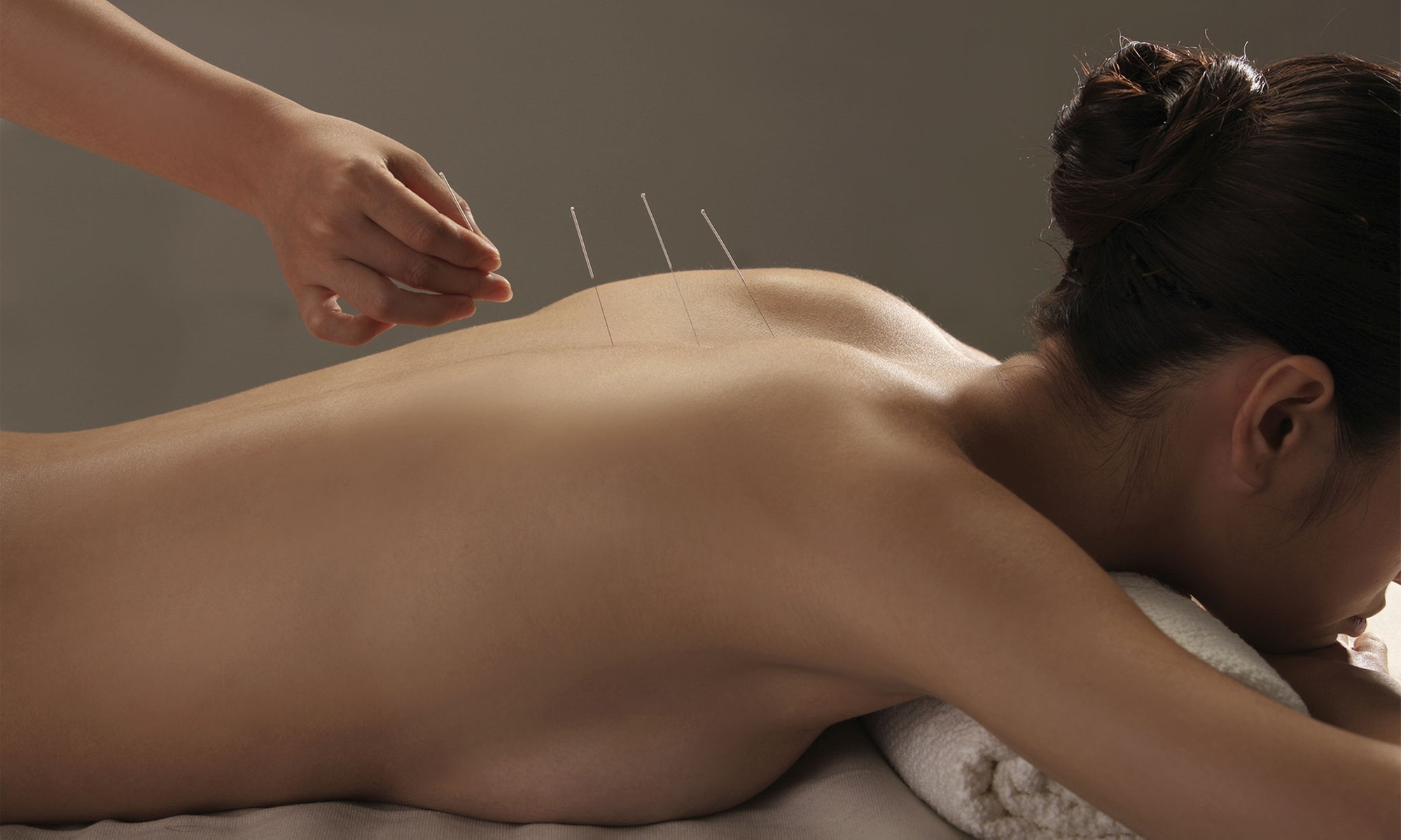 Acupuncture for Well-Being