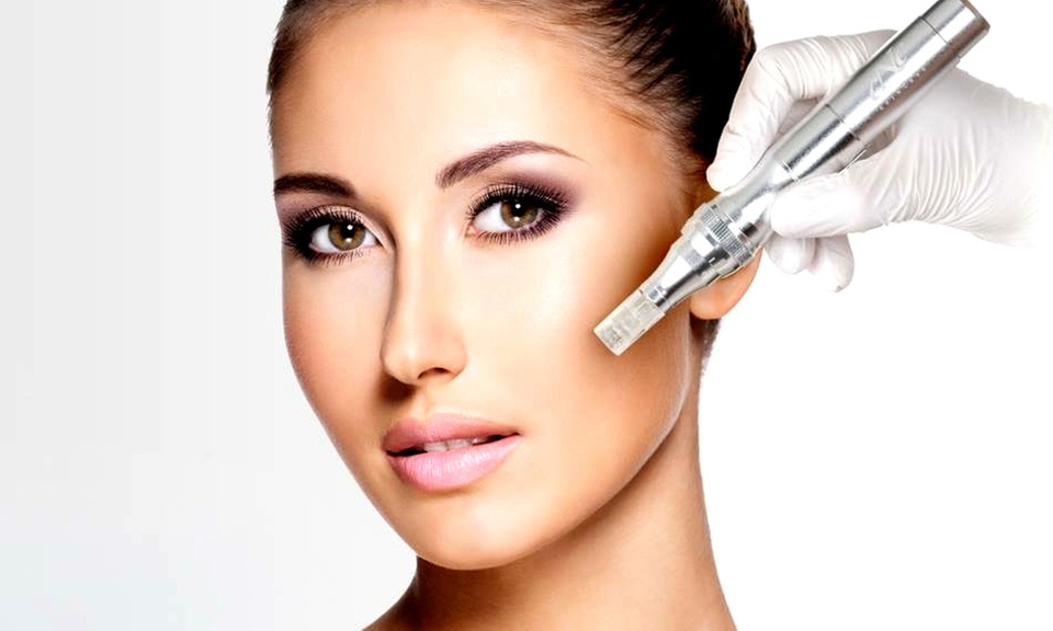 Microneedling-Gesichtsbehandlung