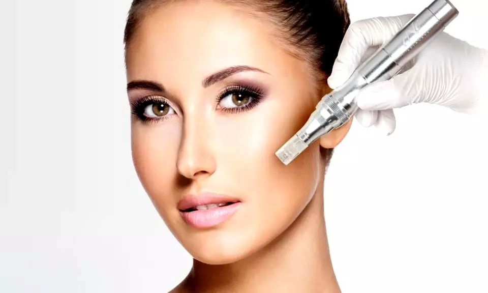 60 Min. Microneedling-Gesichtsbehandlung bei Sirin Kosmetik by Salon Melissa (44% sparen*) - Primary Image