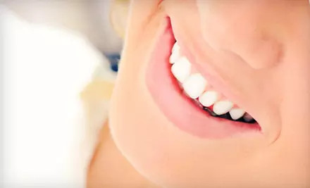 $1,999 for a Dental-Implant Package with Implant, Abutment, Crown, and X-Rays at Icon Dental ($5,337 Value) - Primary Image