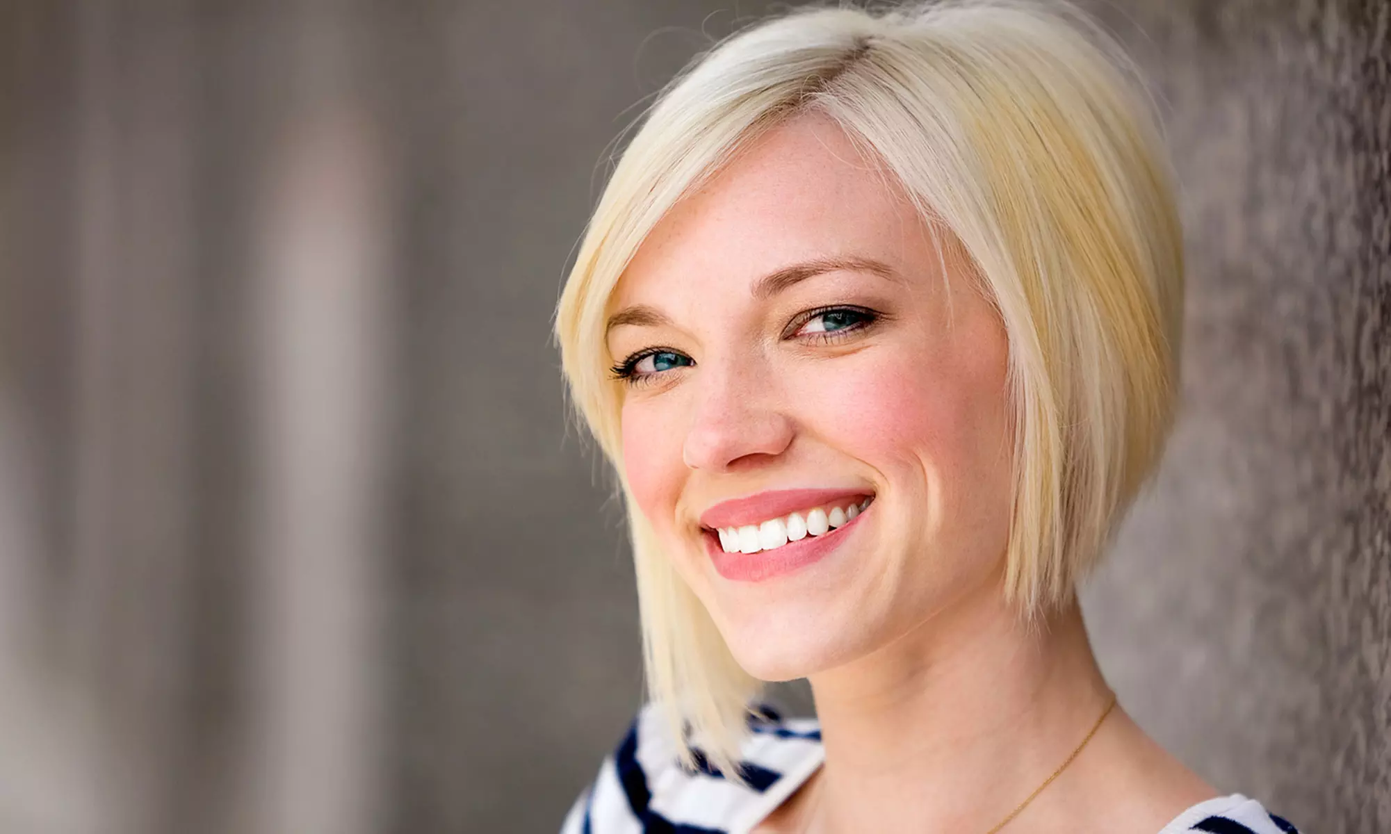 $149 for a Zoom! Teeth-Whitening Treatment at Valley Fair Family and Cosmetic Dentistry ($399 Value) - Primary Image