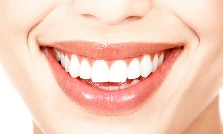 Dental Exam or Zoom! Whitening - Dental Smile Therapy | Groupon