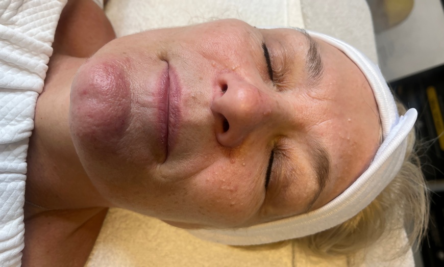 Image 2: 60 or 75-Minute Full Facial With Dermalogica Skincare or LED Therapy