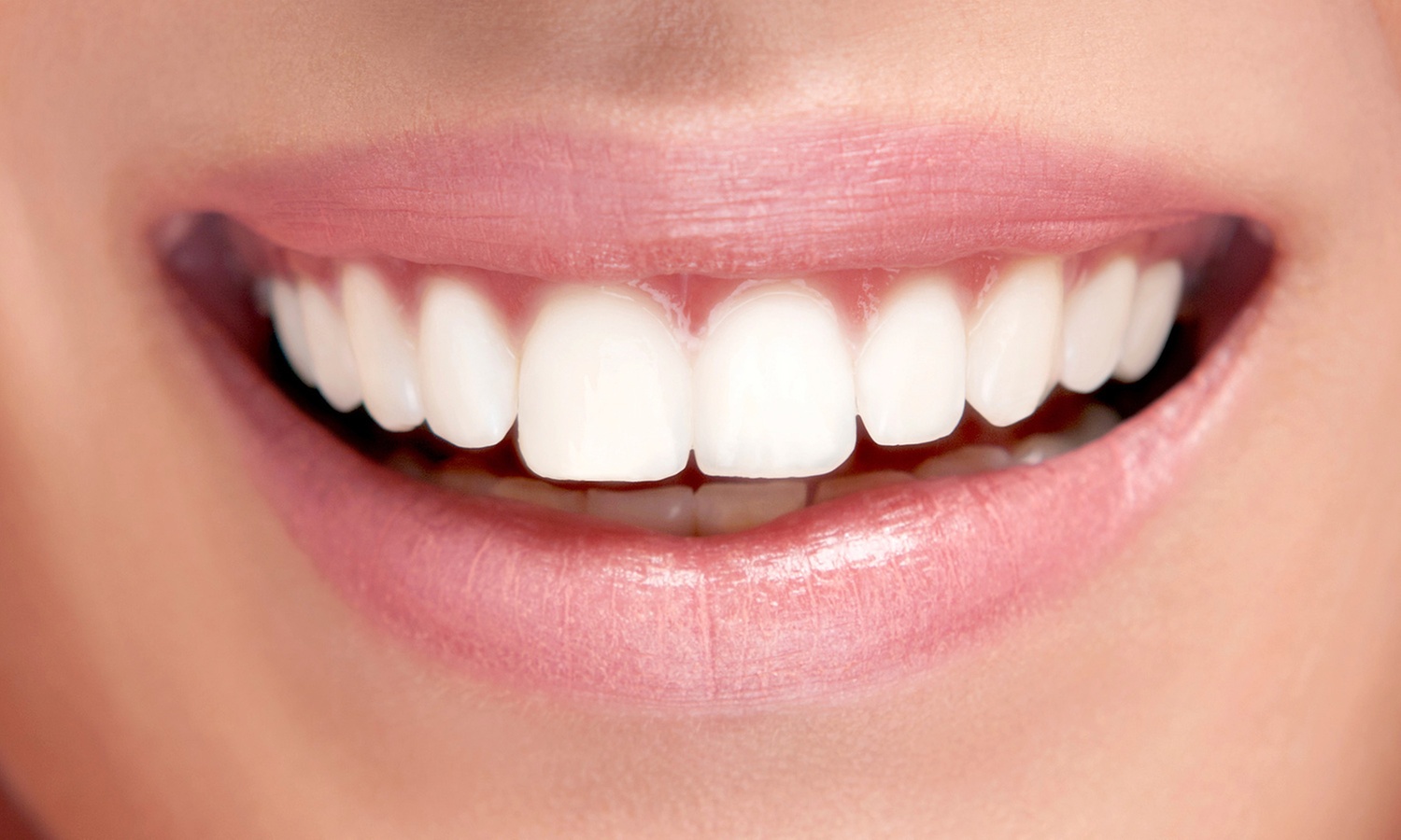 Implante de titanio y limpieza