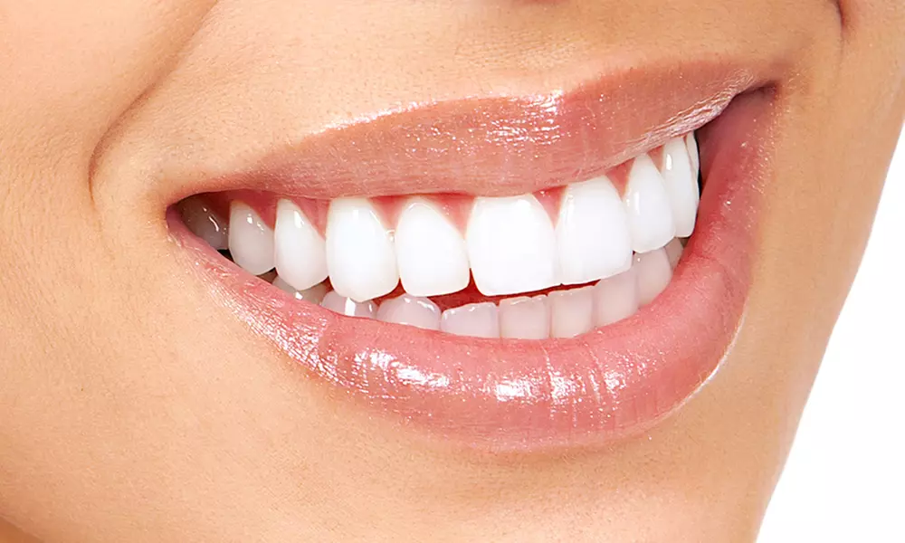 $47 for Dental Cleaning, X-ray and Exam with Dr. Geffen ($280 Value) - Primary Image