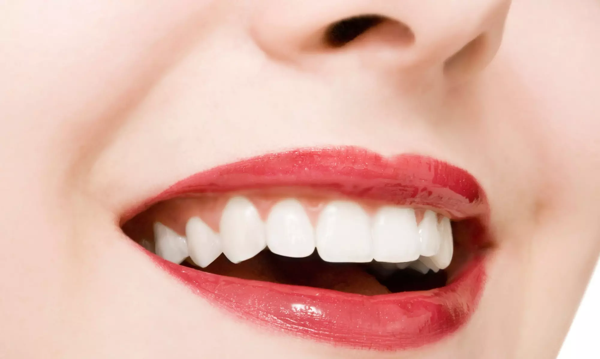 One-Year Dental Plan or $115 for $300 Worth of Dental Procedures at Eureka Dental Group - Primary Image