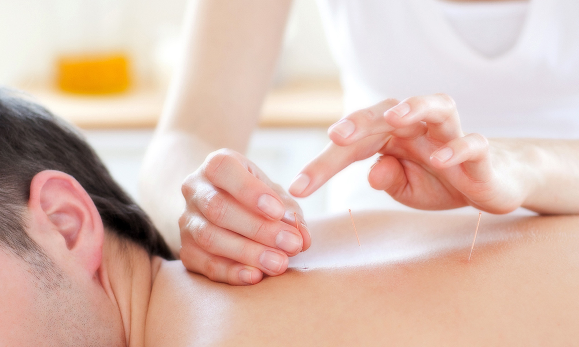 Experience Relaxation with One or Ten Acupuncture Treatments