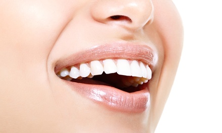 1, 2 o 4 empastes dentales y limpieza bucal desde 12,95 €