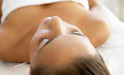 75% Off Acupuncture at Tai Chi Acupuncture & Wellness Center