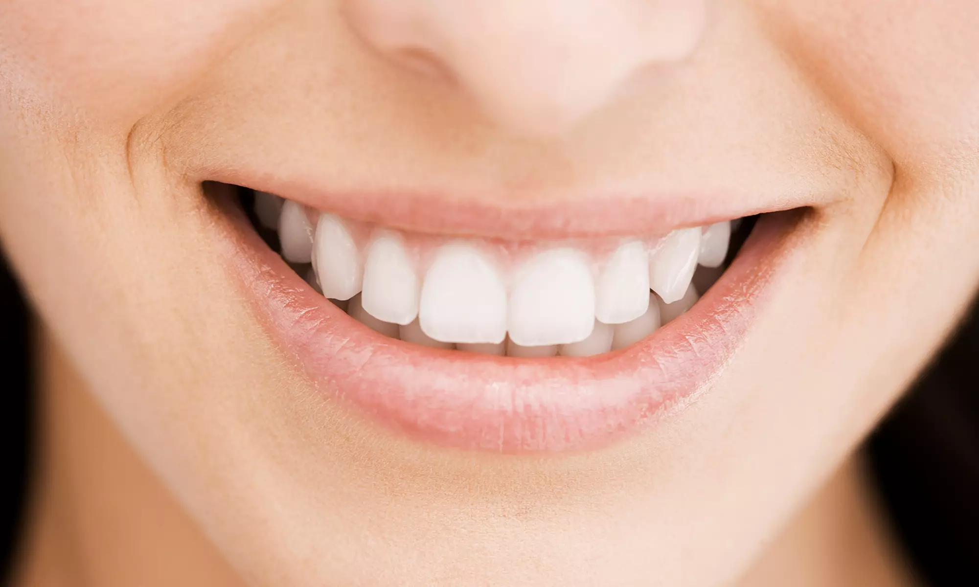 $2,400 for an Advanced Dental Implant at Express Denture Care ($4,000 Value) - Primary Image