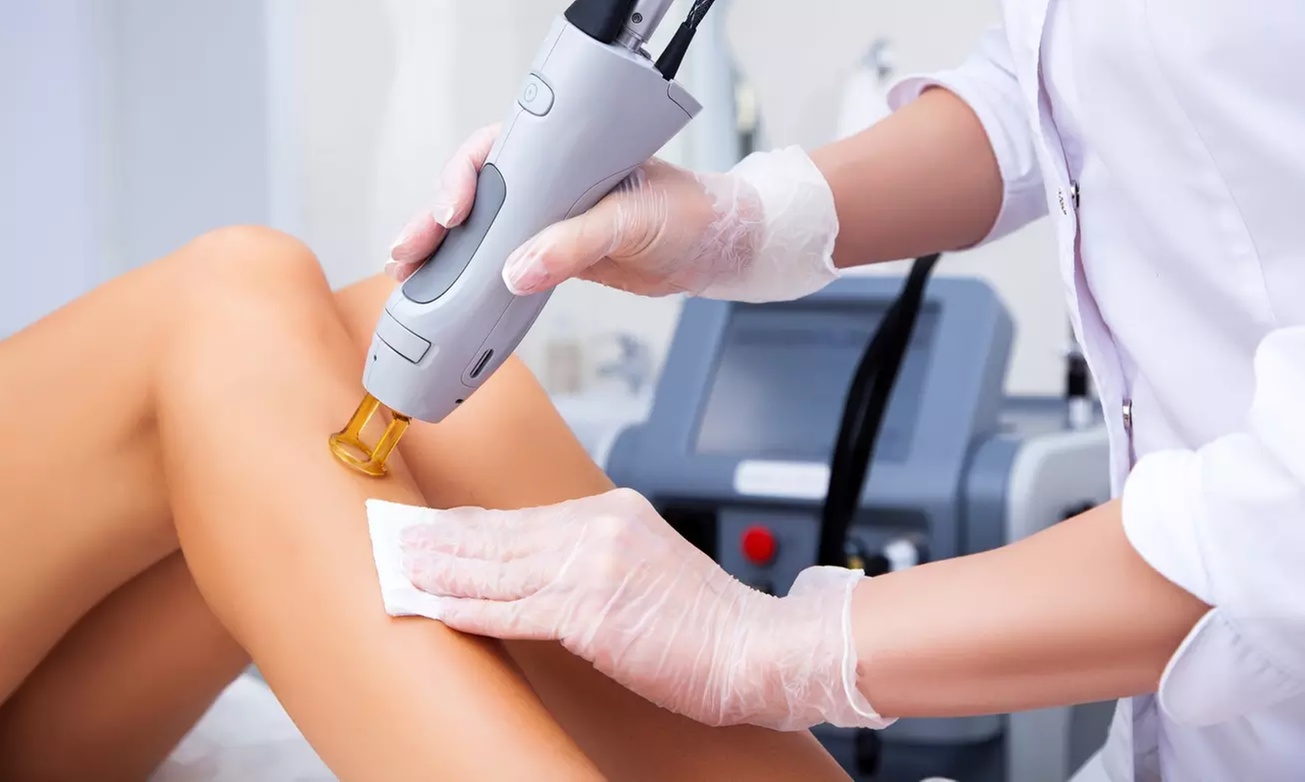 6 Laser Hair Removal Sessions on Medium, Large, or Extra Large Area