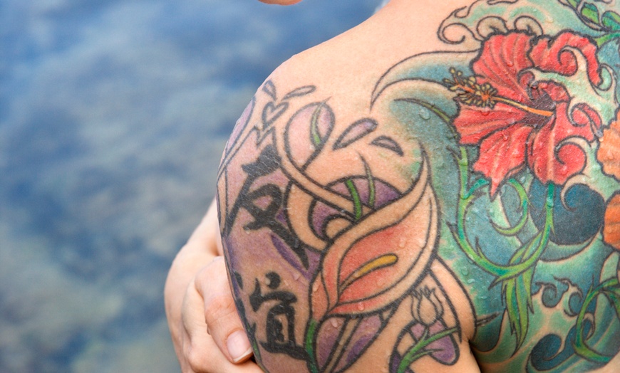 Image 1: 1 or 3 Laser Tattoo Removal Sessions for an Area up to 5″, 10″ or 15″