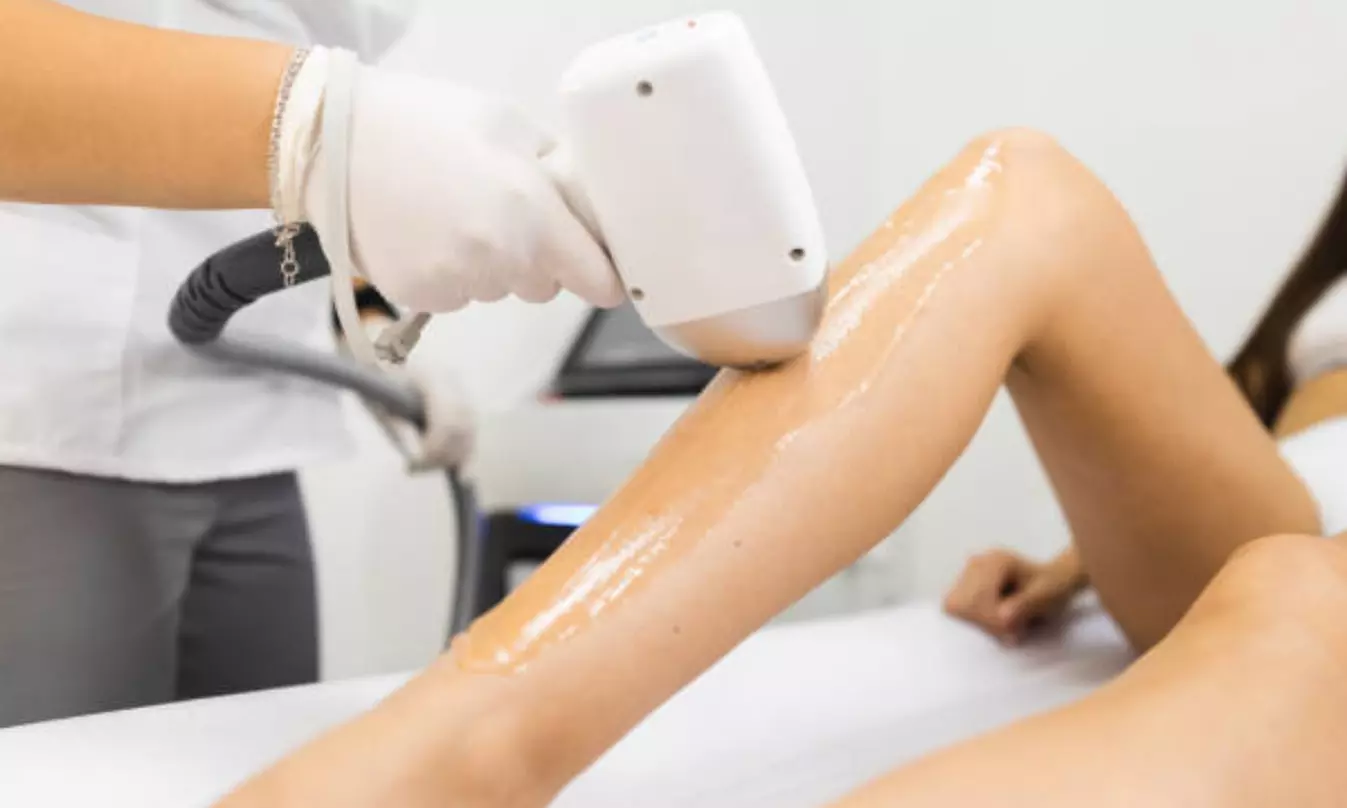 ¡Descubre la depilación láser en Eraesthetic!