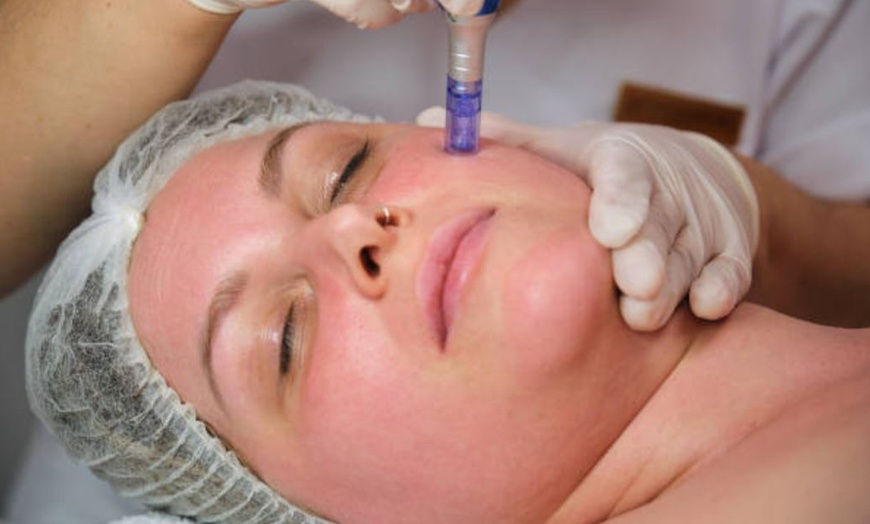 Image 10: 1 o 2 sesiones de limpieza facial con tratamiento a elegir para 1