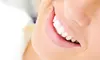 Peroxide- or Botanical-Gel Teeth-Whitening Treatment at Beauty Bar Laser Clinic (Up to 78% Off)