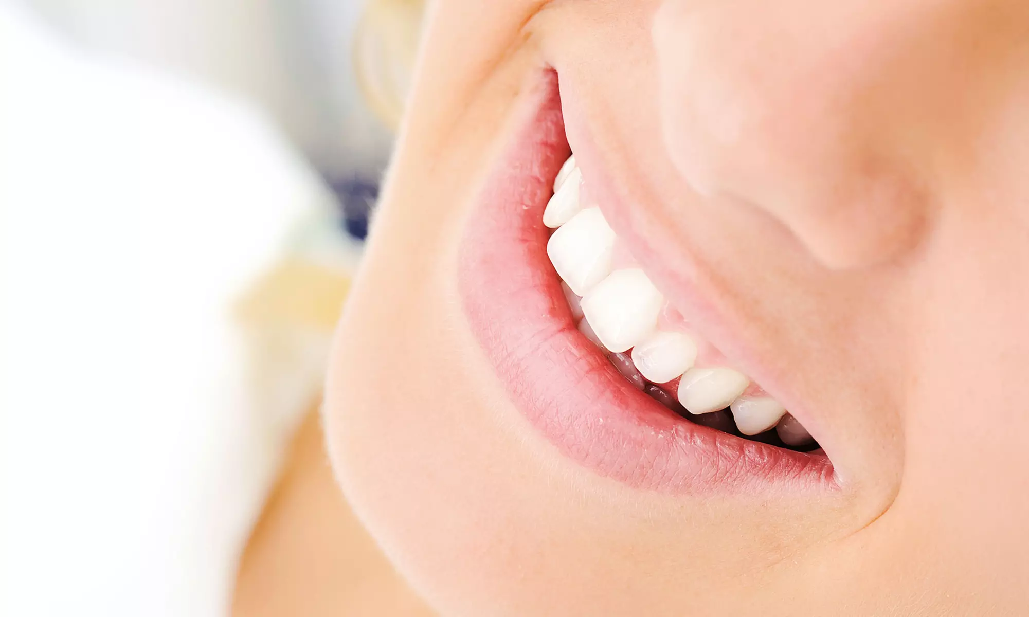 Peroxide- or Botanical-Gel Teeth-Whitening Treatment at Beauty Bar Laser Clinic (Up to 78% Off) - Primary Image