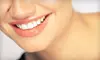 In-Office Custom Teeth Whitening System or Four Porcelain Veneers at Zaibak Center for Dentistry in Tinley Park (Up to 64% Off)