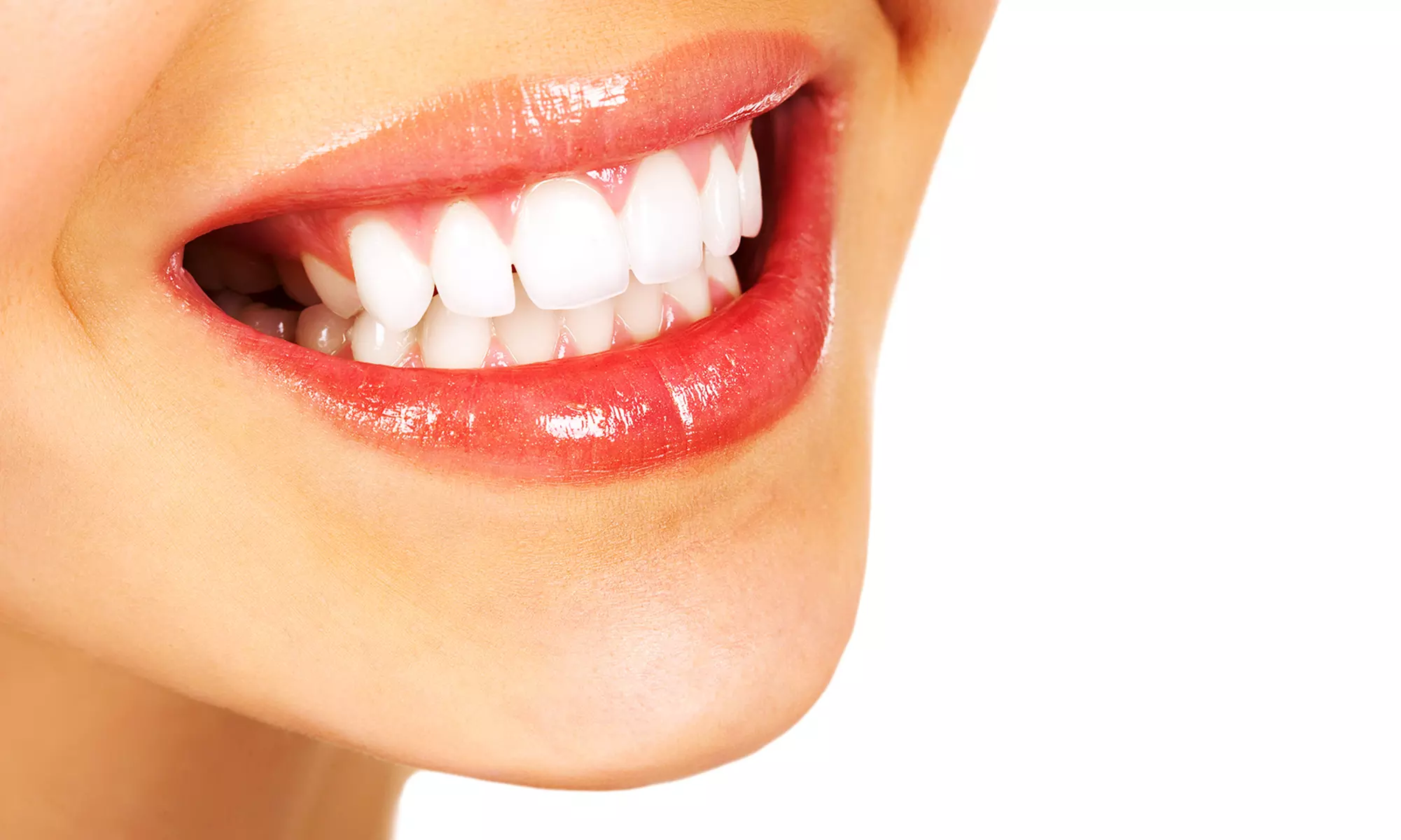 $39 for a Dental Exam, Cleaning, and X-rays from Kenneth A Spanel DDS/ Regency Dental ($155 Value) - Primary Image