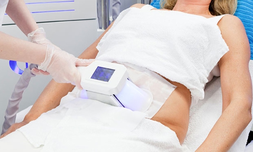 Image 1: Cryolipolysis Treatment