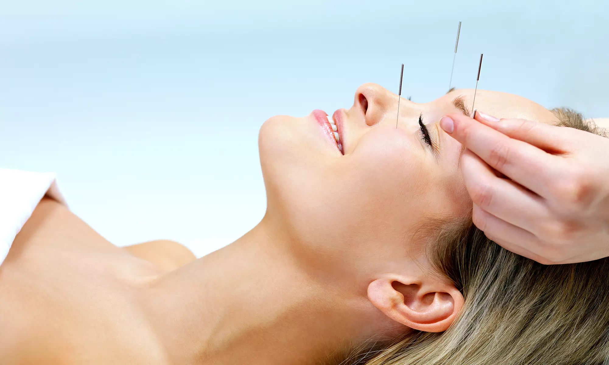 One or Two Acupuncture Treatments at Sun Wellness Center (Up to 74% Off) - Primary Image