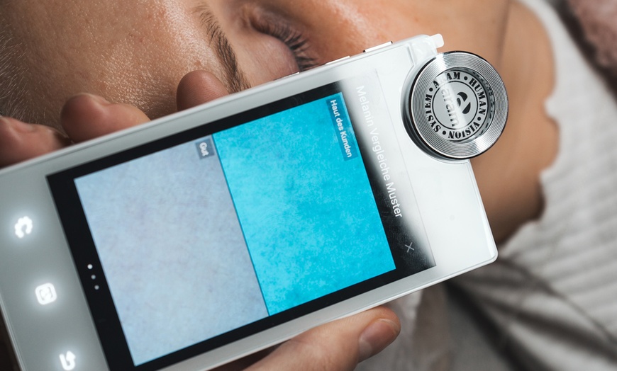 Image 10: Aquafacial mit Microdermabrasion oder Glowstart Gesichtsbehandlung