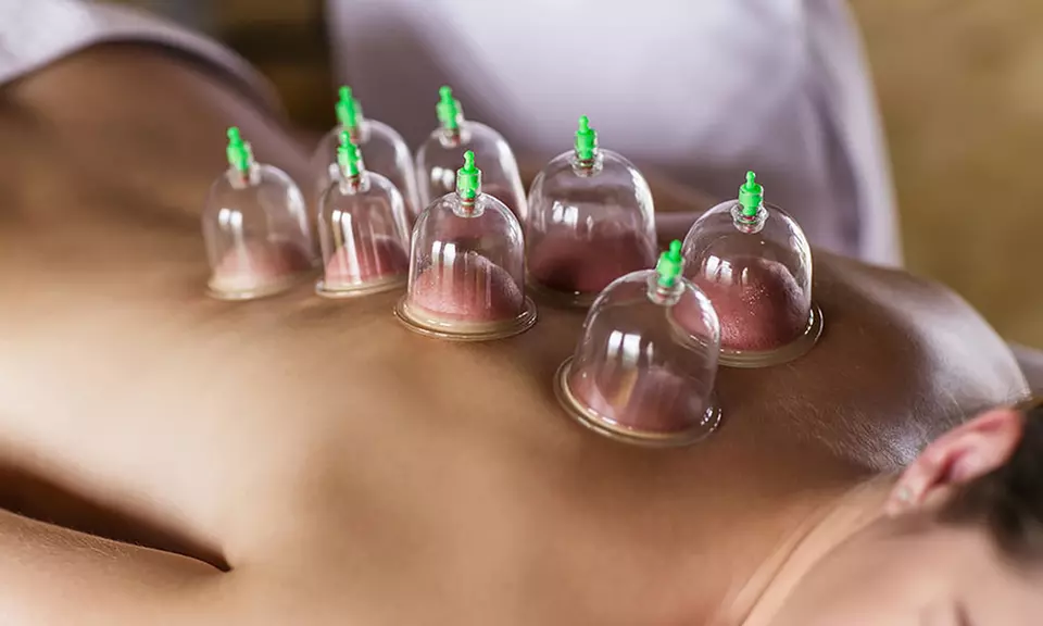 Therapeutic 12-Cup Vacuum Cupping Set with Suction Pump - Primary Image