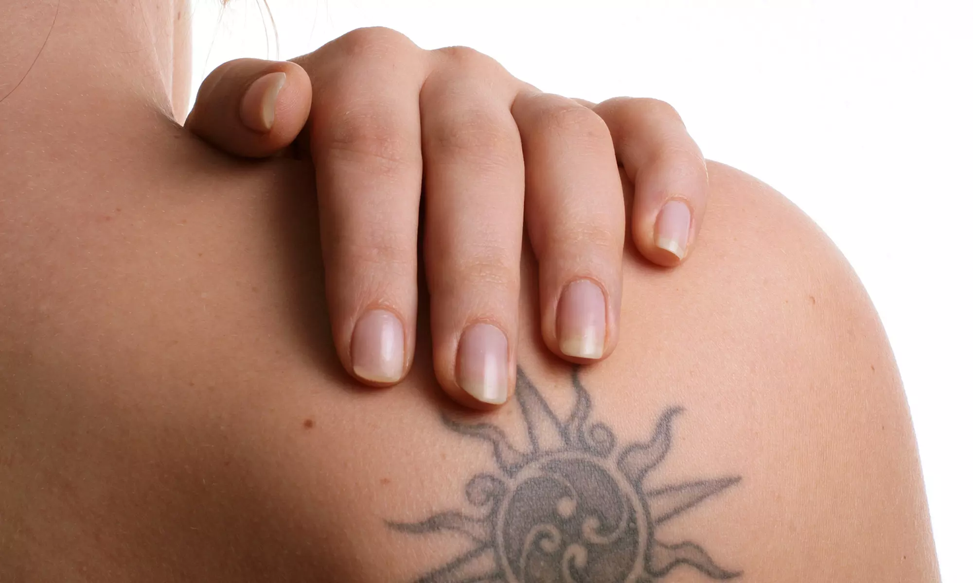 One, Two, or Three Laser Tattoo-Removal Treatments at Precision Laser Tattoo Removal (Up to 81% Off) - Primary Image